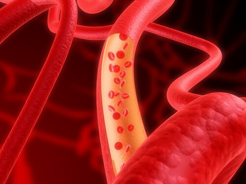 Hành tây giúp nam giới  tăng cường tuần hoàn máu